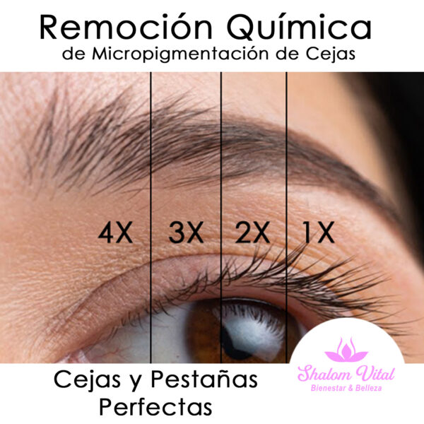 Remoción Química de Micropigmentación de Cejas